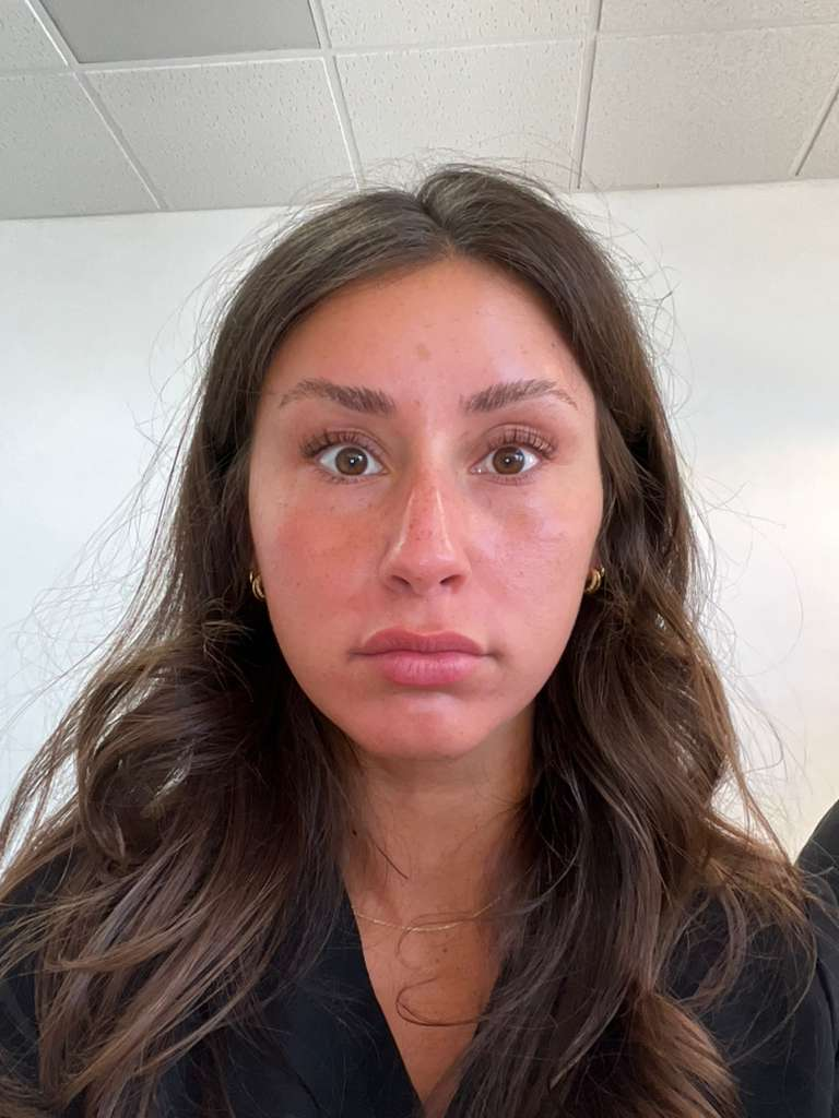 After treatment