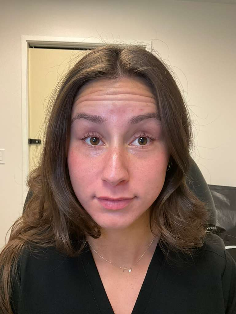 Before treatment