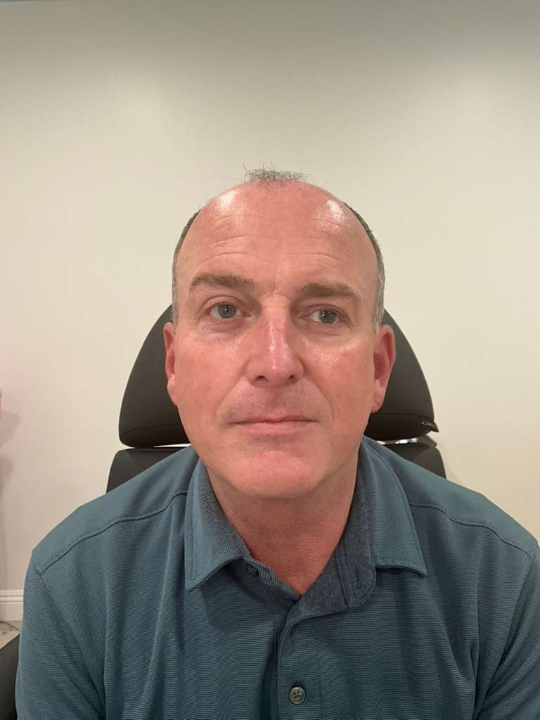 After treatment